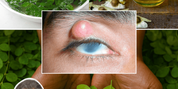 The Miracle Tree That Can Transform Your Health in 2025 – dogpjs.com The Miracle Tree That Can Transform Your Health in 2025 – dogpjs.com