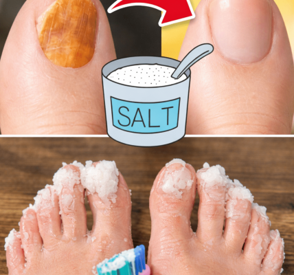 Exploring Simple Home Foot Care Tips: Can Everyday Salt Support Healthy Toenails? Exploring Simple Home Foot Care Tips: Can Everyday Salt Support Healthy Toenails?