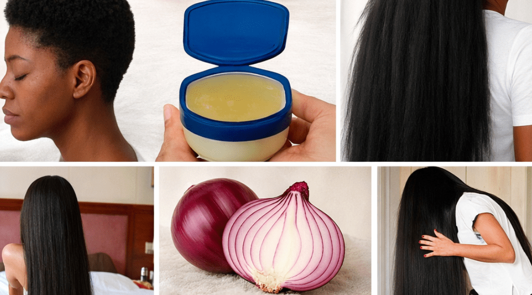 Exploring the Viral Onion and Vaseline Hair Routine: What You Need to Know About This Popular Home Remedy Exploring the Viral Onion and Vaseline Hair Routine: What You Need to Know About This Popular Home Remedy