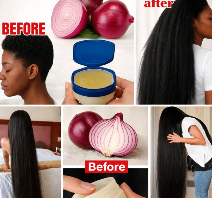 Exploring the Viral Onion and Vaseline Hair Routine: What You Need to Know About This Popular Home Remedy Exploring the Viral Onion and Vaseline Hair Routine: What You Need to Know About This Popular Home Remedy