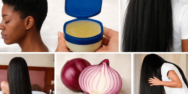 Exploring the Viral Onion and Vaseline Hair Routine: What You Need to Know About This Popular Home Remedy Exploring the Viral Onion and Vaseline Hair Routine: What You Need to Know About This Popular Home Remedy