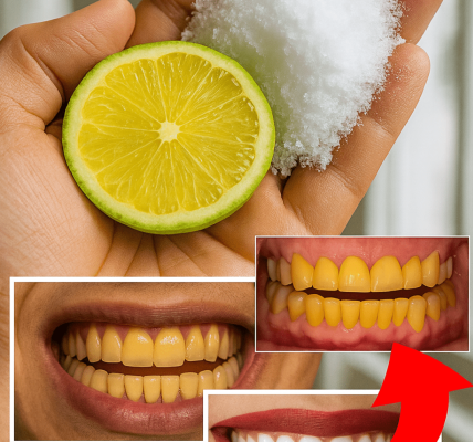Unveiling the Secret: 7 Shockingly Simple Home Remedies That Can Transform Your Smile from Yellow to Dazzling White—No Dentist Appointment Required Unveiling the Secret: 7 Shockingly Simple Home Remedies That Can Transform Your Smile from Yellow to Dazzling White—No Dentist Appointment Required