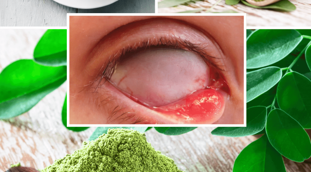 The Miracle Tree: Exploring the 10 Health Benefits of Moringa and How to Use It Daily The Miracle Tree: Exploring the 10 Health Benefits of Moringa and How to Use It Daily