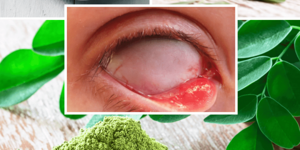 The Miracle Tree: Exploring the 10 Health Benefits of Moringa and How to Use It Daily