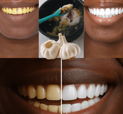 How to Naturally Brighten Your Smile at Home in Just Minutes – A Simple Everyday Trick Thousands Are Trying How to Naturally Brighten Your Smile at Home in Just Minutes – A Simple Everyday Trick Thousands Are Trying