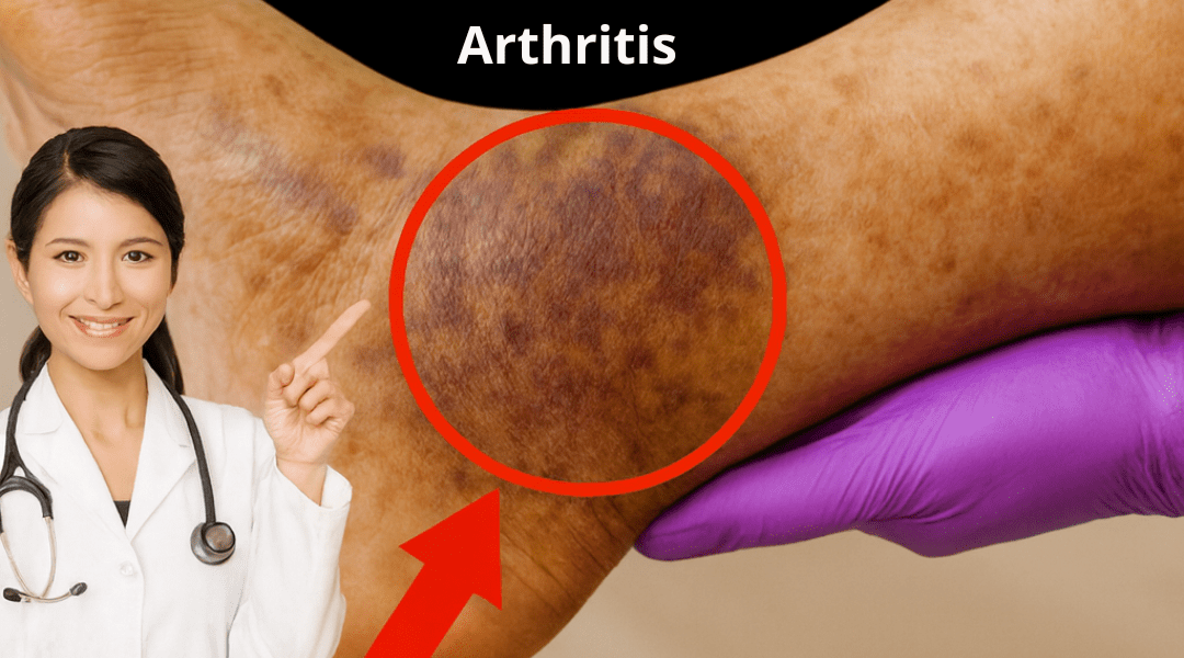 How to Combine Garlic, Ginger, and Cloves: A Simple Guide to Supporting Daily Comfort in Legs and Joints How to Combine Garlic, Ginger, and Cloves: A Simple Guide to Supporting Daily Comfort in Legs and Joints