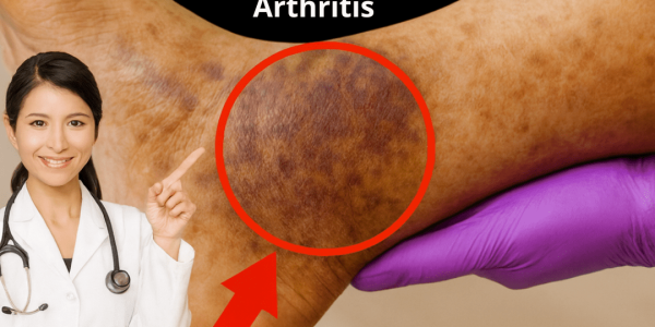 How to Combine Garlic, Ginger, and Cloves: A Simple Guide to Supporting Daily Comfort in Legs and Joints How to Combine Garlic, Ginger, and Cloves: A Simple Guide to Supporting Daily Comfort in Legs and Joints