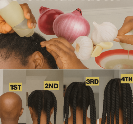 How to Make Onion Hair Oil at Home: A Simple Guide to Supporting Healthy Hair and Scalp