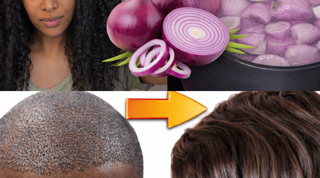 Could Onion Water Be a Simple Kitchen Remedy for Supporting Healthy Hair Growth? Could Onion Water Be a Simple Kitchen Remedy for Supporting Healthy Hair Growth?