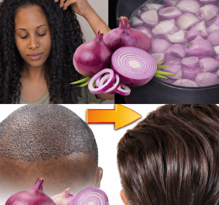 Could Onion Water Be a Simple Kitchen Remedy for Supporting Healthy Hair Growth?