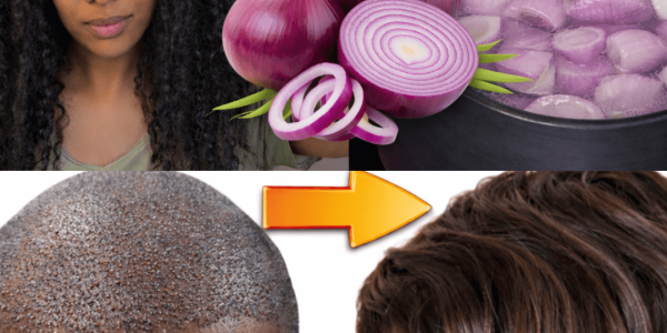 Could Onion Water Be a Simple Kitchen Remedy for Supporting Healthy Hair Growth? Could Onion Water Be a Simple Kitchen Remedy for Supporting Healthy Hair Growth?