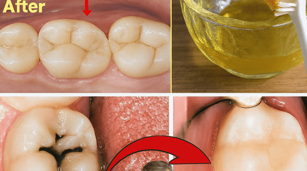 How to Naturally Support Tooth Comfort at Home: Simple Remedies That May Help Reduce Discomfort Fast How to Naturally Support Tooth Comfort at Home: Simple Remedies That May Help Reduce Discomfort Fast