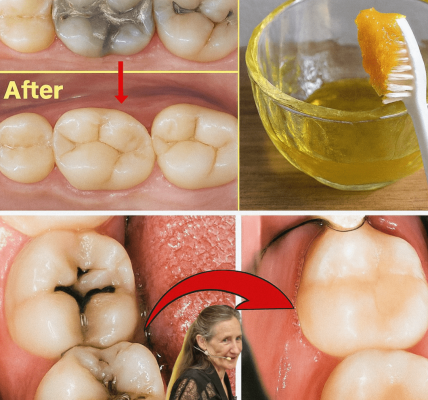 How to Naturally Support Tooth Comfort at Home: Simple Remedies That May Help Reduce Discomfort Fast How to Naturally Support Tooth Comfort at Home: Simple Remedies That May Help Reduce Discomfort Fast