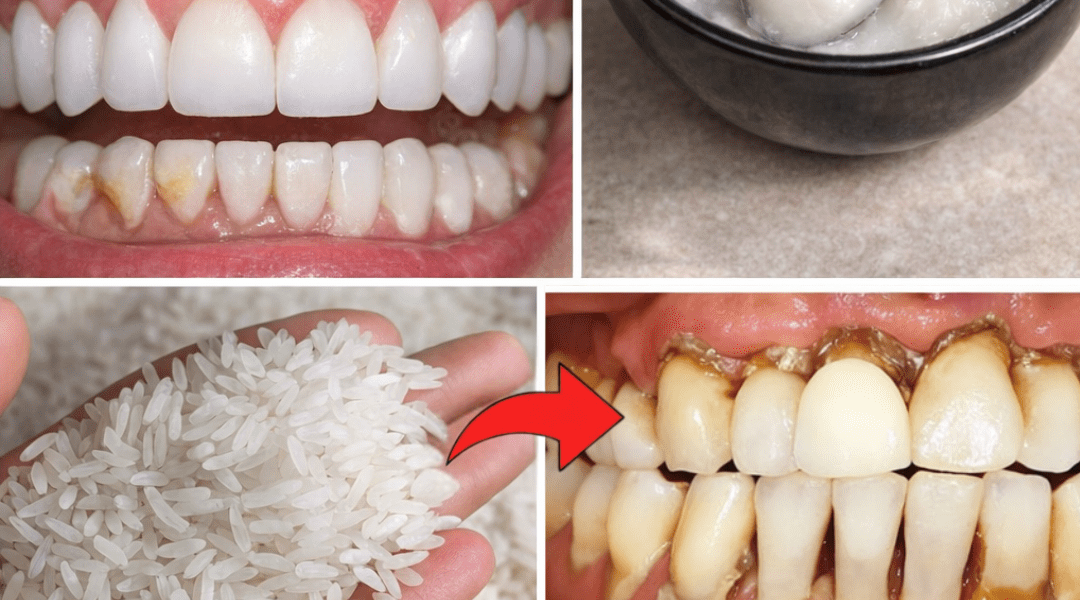 How to Naturally Brighten Your Smile and Reduce Tartar Buildup at Home How to Naturally Brighten Your Smile and Reduce Tartar Buildup at Home