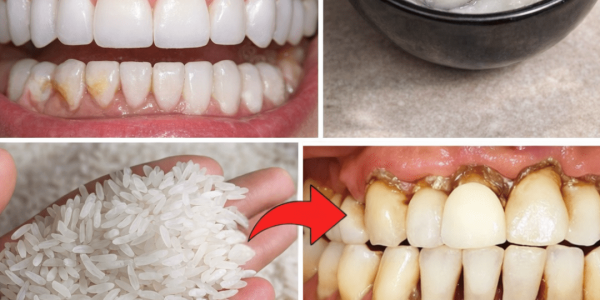 How to Naturally Brighten Your Smile and Reduce Tartar Buildup at Home
