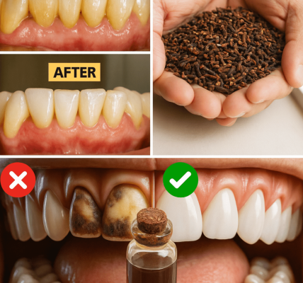 Unveiling the Truth: 9 Natural Secrets to Erase Plaque and Tartar Buildup (Your Dentist Won’t Tell You!) Unveiling the Truth: 9 Natural Secrets to Erase Plaque and Tartar Buildup (Your Dentist Won’t Tell You!)