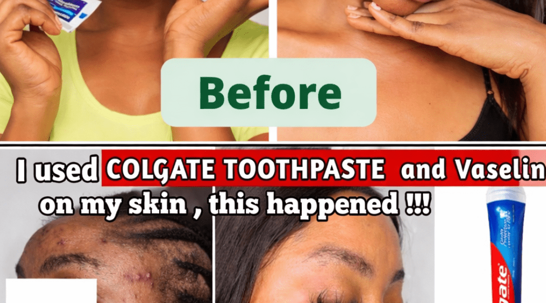 What Happens When You Apply Toothpaste and Vaseline to Your Face? A Closer Look at This Viral Trend What Happens When You Apply Toothpaste and Vaseline to Your Face? A Closer Look at This Viral Trend