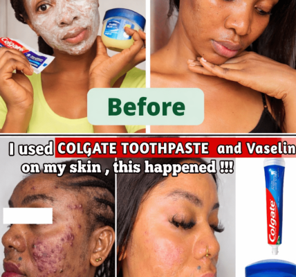 What Happens When You Apply Toothpaste and Vaseline to Your Face? A Closer Look at This Viral Trend