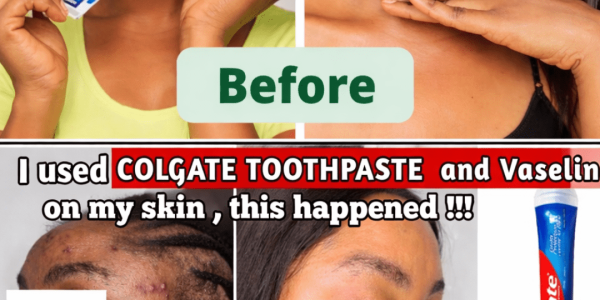 What Happens When You Apply Toothpaste and Vaseline to Your Face? A Closer Look at This Viral Trend