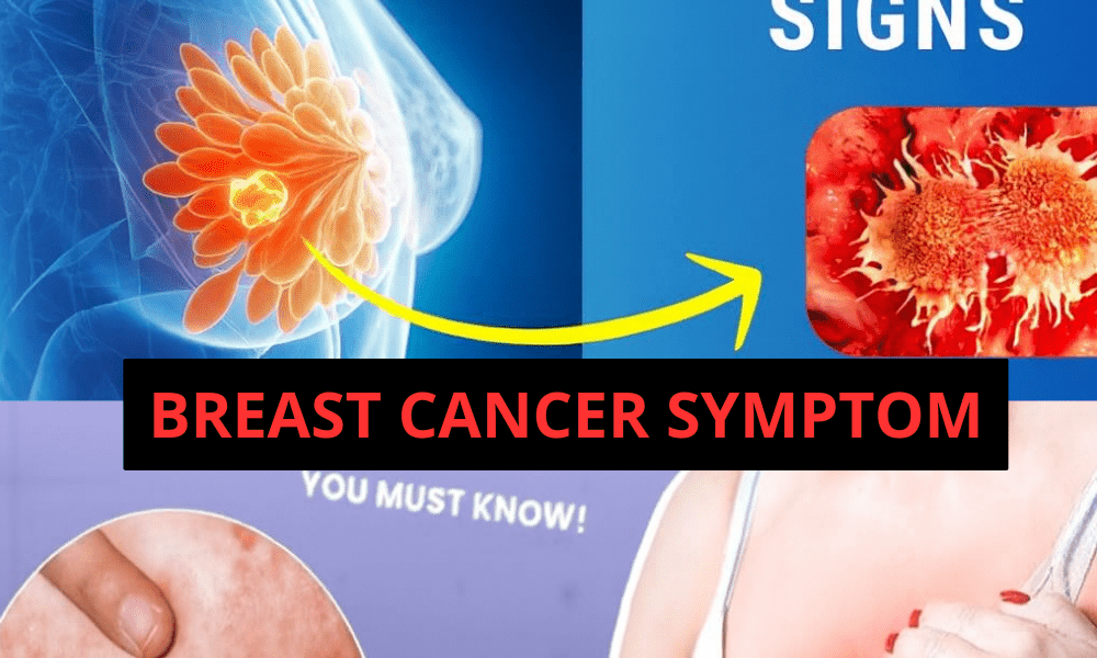 10 Warning Signs of Breast Cancer You Should Never Ignore (Early Detection Can Save Your Life) 10 Warning Signs of Breast Cancer You Should Never Ignore (Early Detection Can Save Your Life)