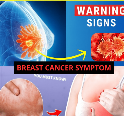 10 Warning Signs of Breast Cancer You Should Never Ignore (Early Detection Can Save Your Life)