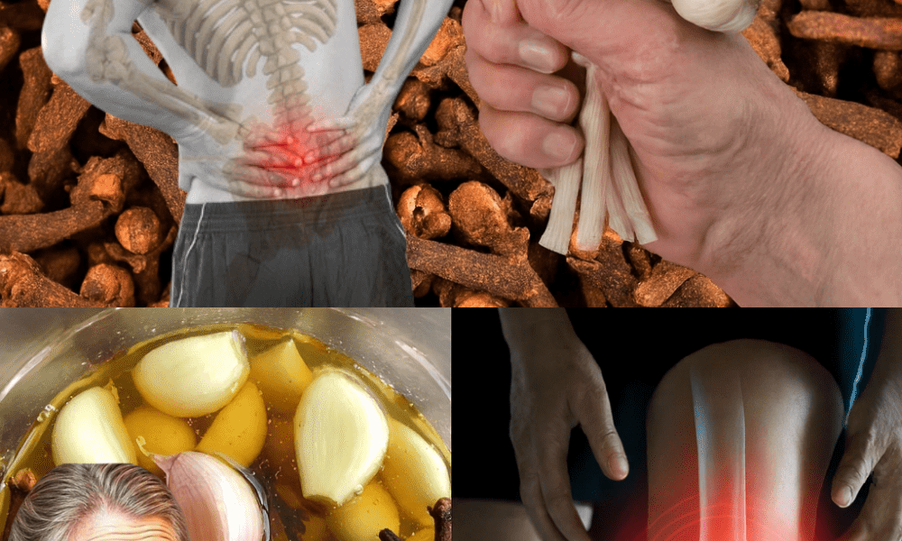 Can Garlic and Cloves Naturally Support Better Circulation and Reduce the Appearance of Varicose Veins?