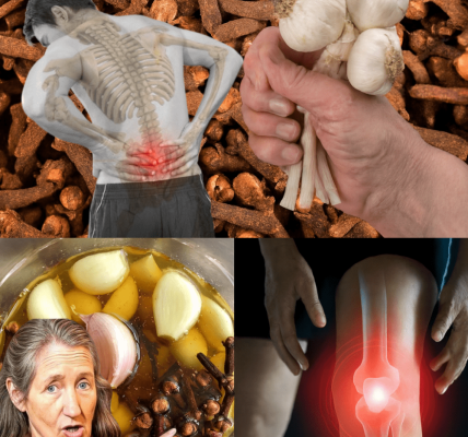 Can Garlic and Cloves Naturally Support Better Circulation and Reduce the Appearance of Varicose Veins? Can Garlic and Cloves Naturally Support Better Circulation and Reduce the Appearance of Varicose Veins?