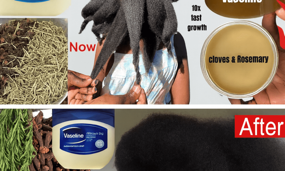 How to Use Cloves and Vaseline for a Healthier-Looking Scalp and Stronger Hair Naturally How to Use Cloves and Vaseline for a Healthier-Looking Scalp and Stronger Hair Naturally