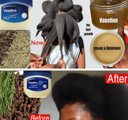 How to Use Cloves and Vaseline for a Healthier-Looking Scalp and Stronger Hair Naturally How to Use Cloves and Vaseline for a Healthier-Looking Scalp and Stronger Hair Naturally
