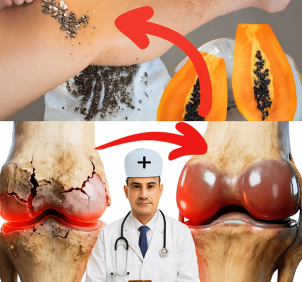 Can Papaya Seeds Help Soothe Everyday Knee, Back, and Spine Discomfort? A Simple Home Remedy Worth Trying