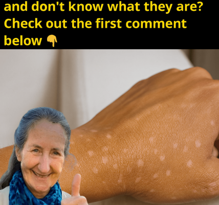 Small White Spots On Your Arms Or Legs: What They Could Mean And When To Worry