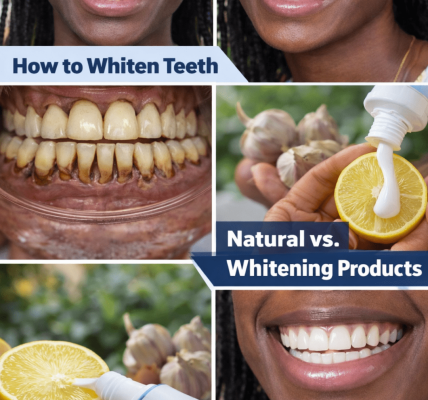 How I Gently Brightened My Yellow Teeth in Just 2 Minutes a Day with This Simple Home Tip How I Gently Brightened My Yellow Teeth in Just 2 Minutes a Day with This Simple Home Tip