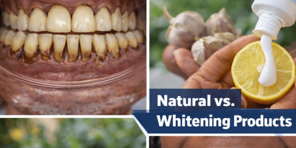 How I Gently Brightened My Yellow Teeth in Just 2 Minutes a Day with This Simple Home Tip How I Gently Brightened My Yellow Teeth in Just 2 Minutes a Day with This Simple Home Tip