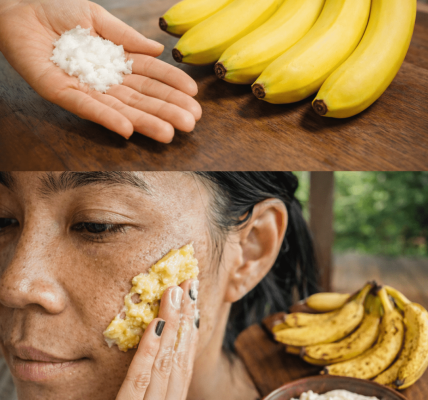 Discover Simple Ways to Incorporate Banana Peels into Your Natural At-Home Skin Care Routine