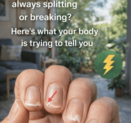 Why Your Nails Keep Splitting or Breaking – And What It Might Be Telling You About Your Body Why Your Nails Keep Splitting or Breaking – And What It Might Be Telling You About Your Body