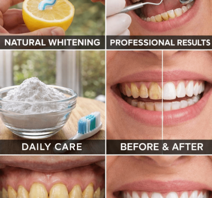 A Common Home Remedy People Try for Brighter-Looking Teeth: Baking Soda and Lemon
