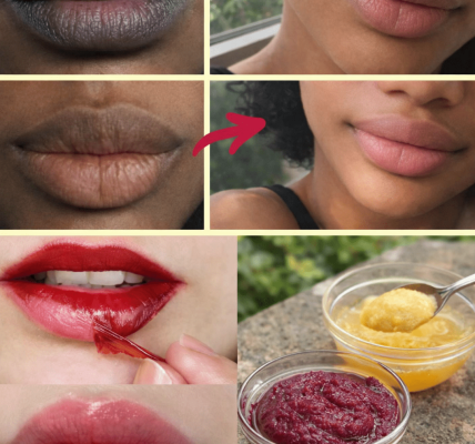 Many people notice their lips becoming darker over time, and it can feel frustrating when it affects confidence in everyday smiles or photos.