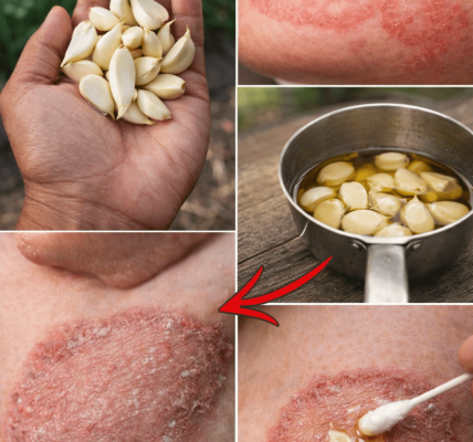 Garlic and Olive Oil: Exploring a Traditional Home Approach for Soothing Fungal Skin Discomfort Naturally Garlic and Olive Oil: Exploring a Traditional Home Approach for Soothing Fungal Skin Discomfort Naturally