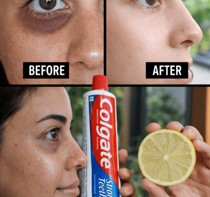 Toothpaste and Lemon for Dark Circles: Does It Really Work? (Dermatologist-Backed Truth) Toothpaste and Lemon for Dark Circles: Does It Really Work? (Dermatologist-Backed Truth)