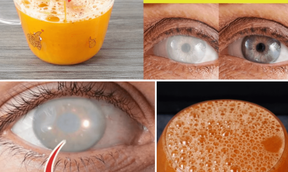 8 Natural Ways to Treat Eye Problems and Improve Your Vision Naturally 8 Natural Ways to Treat Eye Problems and Improve Your Vision Naturally