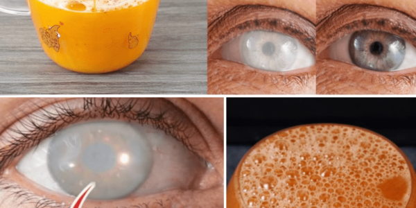 8 Natural Ways to Treat Eye Problems and Improve Your Vision Naturally 8 Natural Ways to Treat Eye Problems and Improve Your Vision Naturally