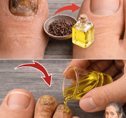 Explore Common Approaches to Managing Toenail Fungus: Insights on Home Options and When to Seek Help