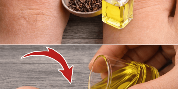 Explore Common Approaches to Managing Toenail Fungus: Insights on Home Options and When to Seek Help