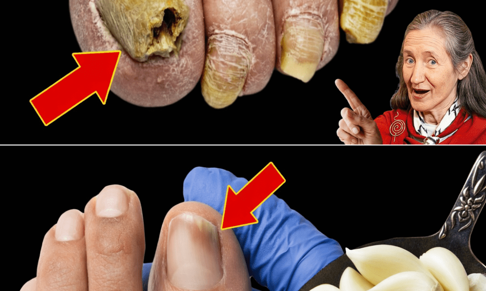 The Garlic Trick That Could Help Restore Your Toenail Health