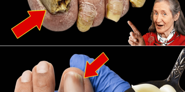 The Garlic Trick That Could Help Restore Your Toenail Health