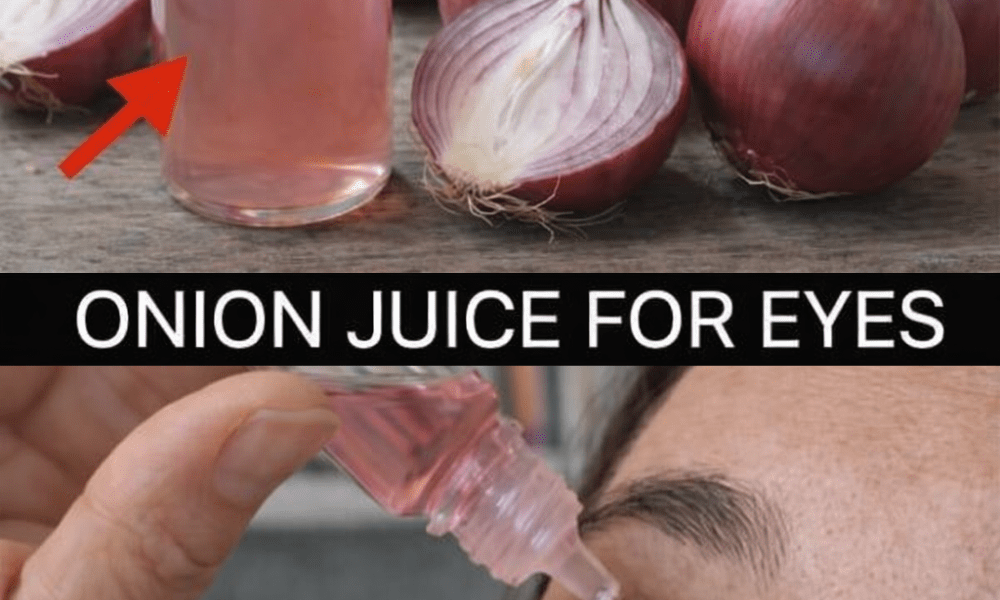 How Can Onions Help Support Your Eye Health Naturally at Home? How Can Onions Help Support Your Eye Health Naturally at Home?