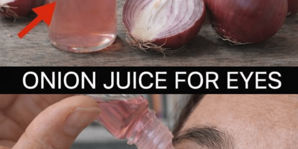 How Can Onions Help Support Your Eye Health Naturally at Home?