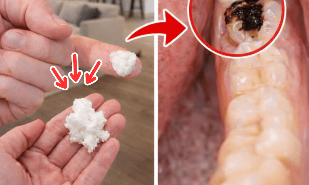 Simple Natural Tips to Keep Your Teeth Healthy: 5 Powerful Home Remedies That May Help Prevent Cavities and Reduce Dental Visits