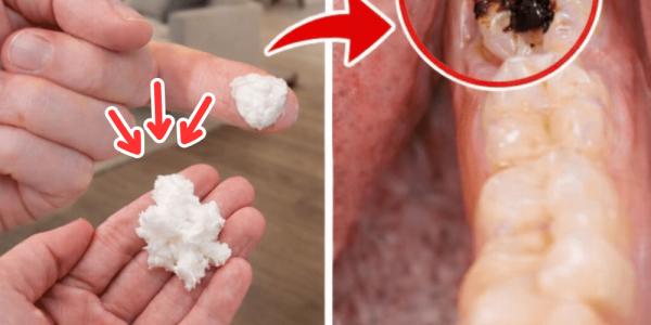 Simple Natural Tips to Keep Your Teeth Healthy: 5 Powerful Home Remedies That May Help Prevent Cavities and Reduce Dental Visits Simple Natural Tips to Keep Your Teeth Healthy: 5 Powerful Home Remedies That May Help Prevent Cavities and Reduce Dental Visits