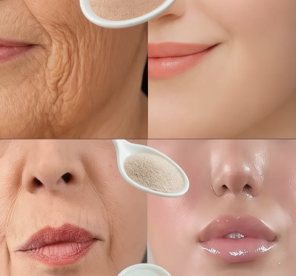 Yeast and yogurt remove all wrinkles in 3 minutes. Even at 70 years old